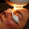 Laser Treatments